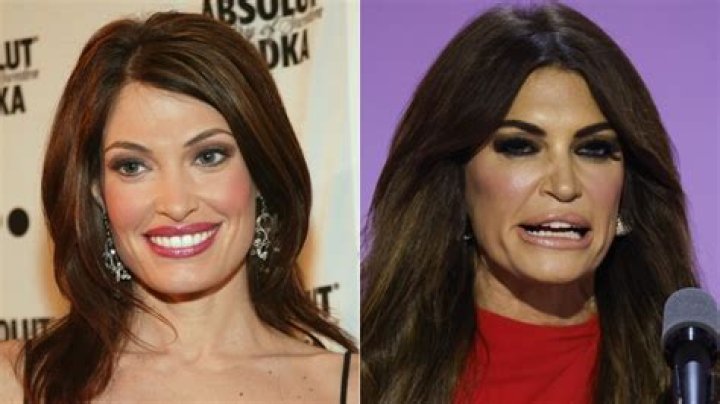 The Transformation Of Kimberly Guilfoyle: A Visual Journey