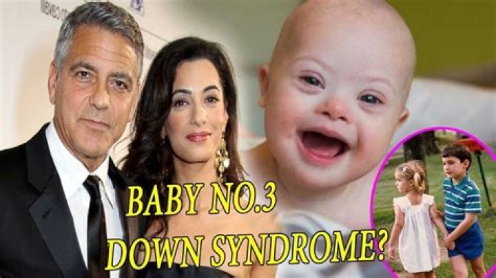 Analyzing The Truth: George Clooney And The Rumors Of A Down Syndrome Child