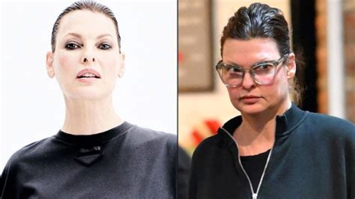 Linda Evangelista's Coolsculpting Journey: A Transformative Experience